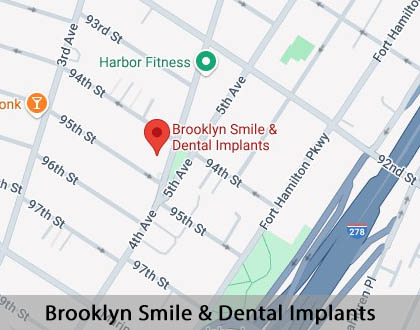 Map image for All-on-4® Implants in Brooklyn, NY